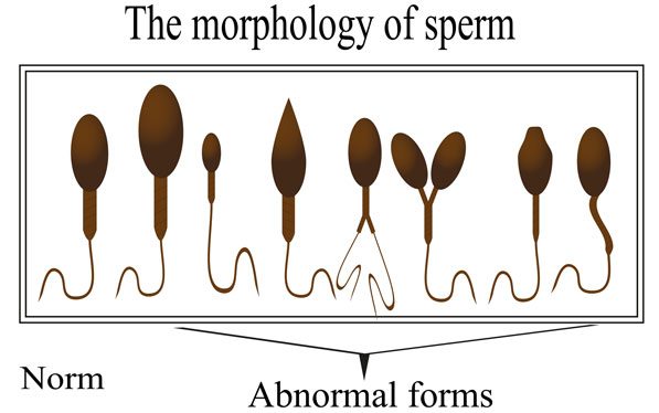 sperm morphology